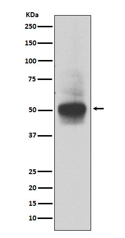 Western blot analysis of RUNX1/RUNX2/RUNX3 expression in MOLT4 cell lysate
