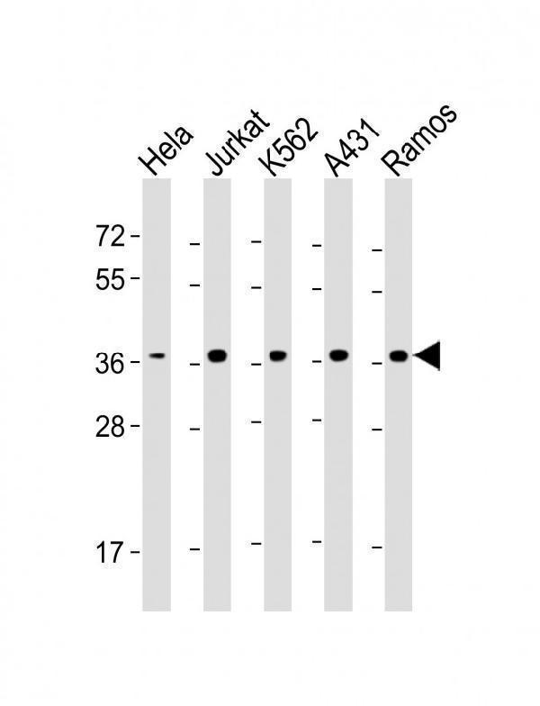m00088 2 anti rad51 antibody wb testing 1