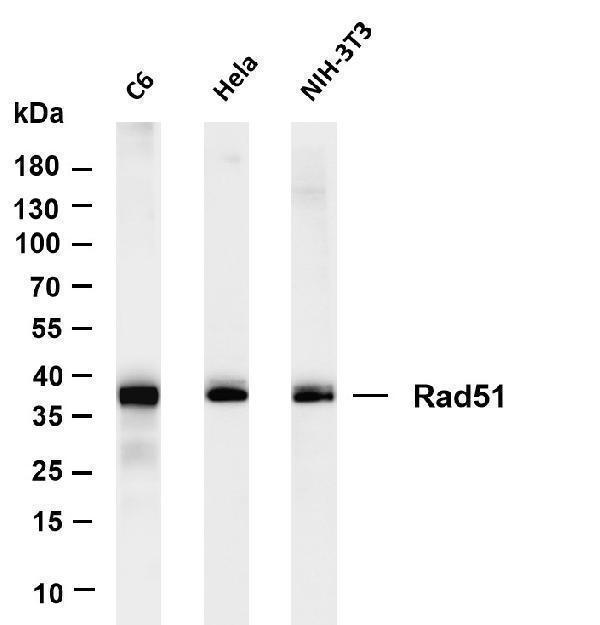 Various whole cell lysates were separated by 4-20% SDS-PAGE, and the membrane was blotted with anti-Rad51 antibody