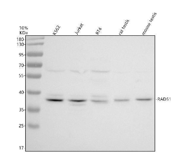 Western blot analysis of RAD51 using anti-RAD51 antibody (M00088-4)