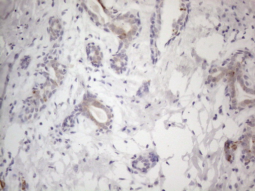 Immunohistochemical staining of paraffin-embedded Human breast tissue within the normal limits using anti-HGF mouse monoclonal antibody