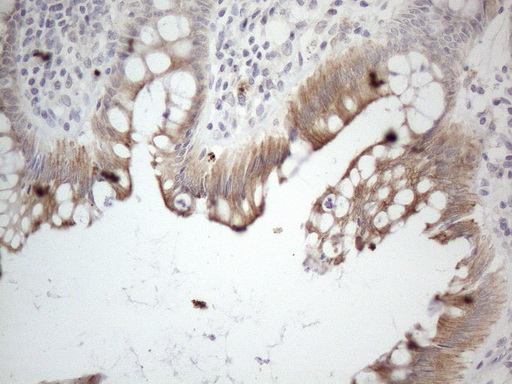 m00089 anti hgf mouse monoclonal antibody clone id oti1d2 ihc testing 5