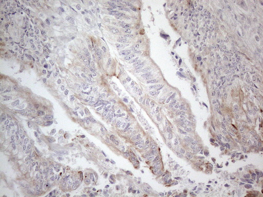 m00089 anti hgf mouse monoclonal antibody clone id oti1d2 ihc testing 6