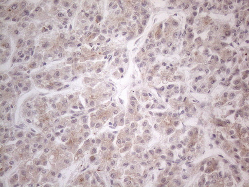 m00089 anti hgf mouse monoclonal antibody clone id oti1d2 ihc testing 7