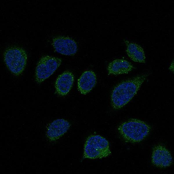 Immunofluorescent analysis of Hela cells, using Smad2 Antibody