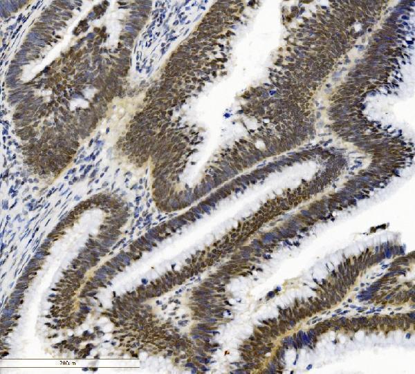 IHC analysis of SMAD2 using anti-SMAD2 antibody (M00090-3)