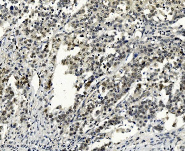 m00090 3 smad2 primary antibodies ihc testing 4
