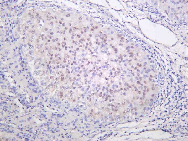 m00090 5 smad2 primary antibodies ihc testing 1
