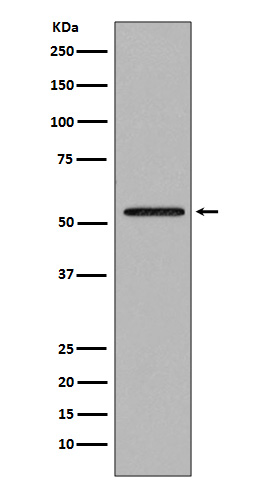 Western blot analysis of Smad2 expression in Jurkat cell lysate