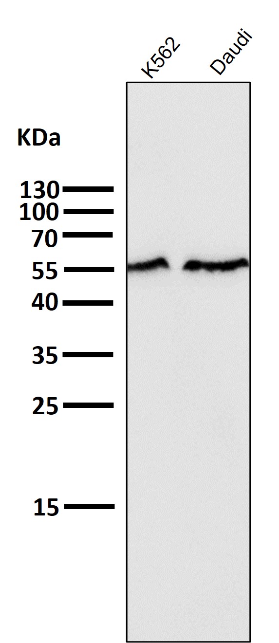 All lanes use the Antibody at 1:5K dilution for 1 hour at room temperature