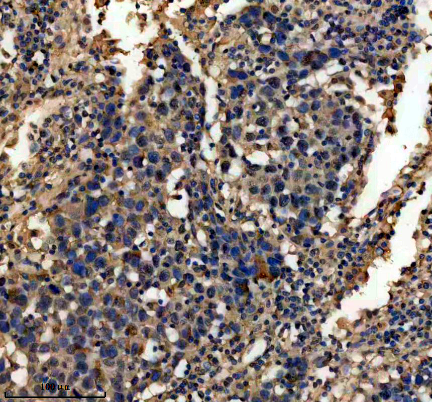 IHC analysis of PML using anti-PML antibody (M00093)