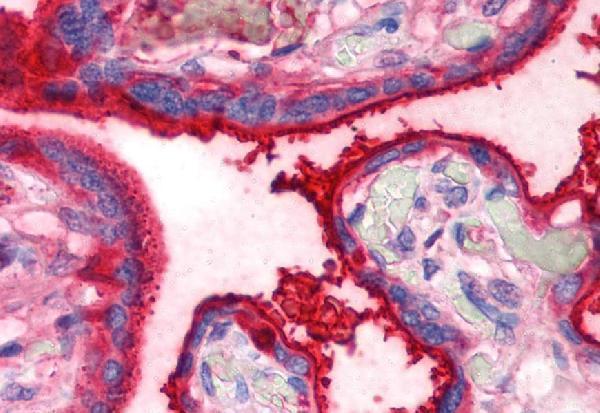 m00094 1 transferrin primary antibodies ihc testing 2