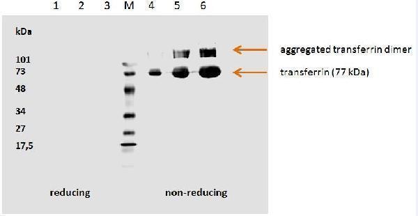 m00094 1 transferrin primary antibodies wb testing 1