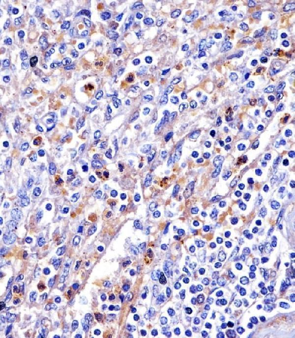 M00094-2 staining Transferrin in human spleen tissue sections by Immunohistochemistry (IHC-P -paraformaldehyde-fixed, paraffin-embedded sections)