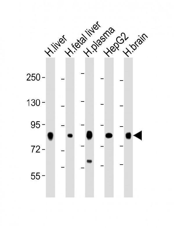 All lanes : Anti-Transferrin Antibody at 1:2000 dilutionLane 1: human liver lysateLane 2: human fetal liver lysateLane 3: human plasma lysateLane 4: HepG2 whole cell lysateLane 5: human brain lysateLysates/proteins at 20 µg per lane