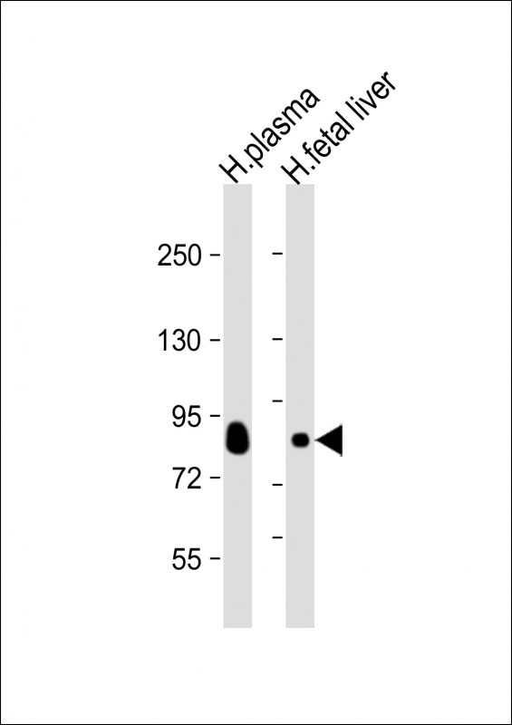 All lanes : Anti-Transferrin Antibody at 1:2000 dilutionLane 1: human plasma lysateLane 2: human fetal liver lysateLysates/proteins at 20 µg per lane