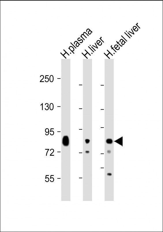 All lanes : Anti-Transferrin Antibody at 1:2000 dilutionLane 1: human plasma lysateLane 2: human liver lysateLane 3: human fetal liver lysateLysates/proteins at 20 µg per lane