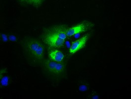 m00094 4 anti transferrin tf mouse monoclonal antibody clone id oti5g2 if testing 5