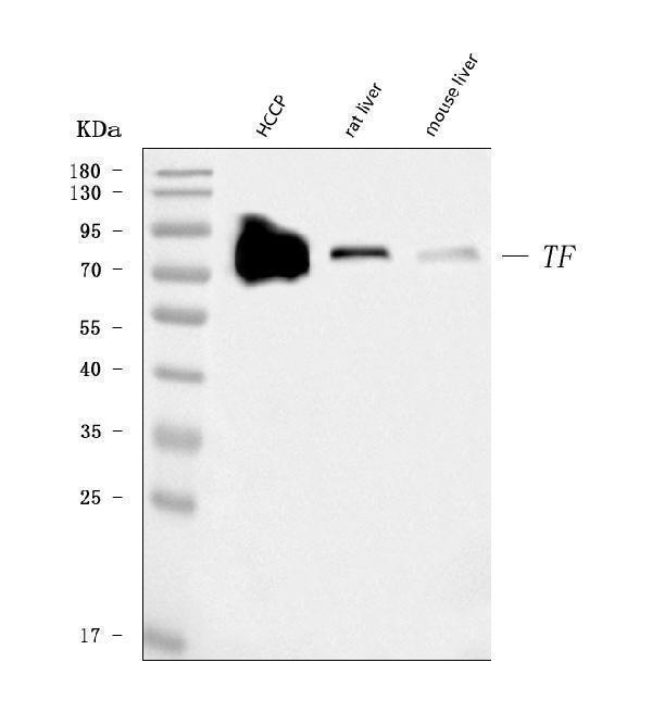  Western blot analysis of Transferrin/TF using anti-Transferrin/TF antibody (M00094-5)