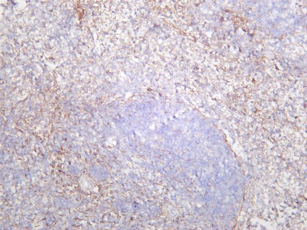 m00096 6 pdgfrb primary antibodies ihc testing 1