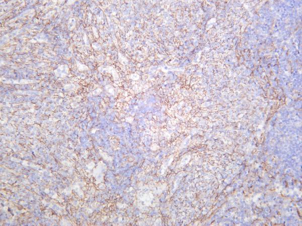 m00096 6 pdgfrb primary antibodies ihc testing 2