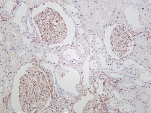 m00096 6 pdgfrb primary antibodies ihc testing 3