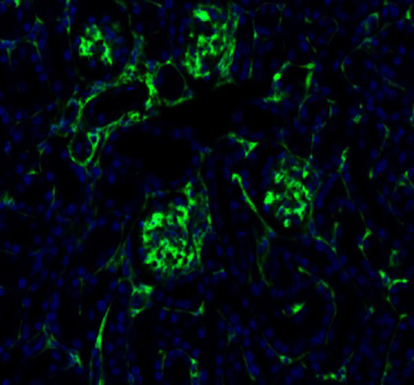 m00096 7 pdgfrb primary antibodies if testing 1