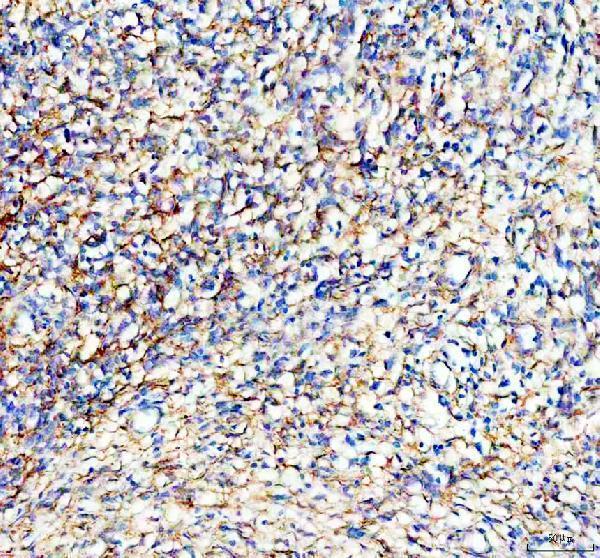 IHC analysis of PDGFRB using anti-PDGFRB antibody (M00096-7)