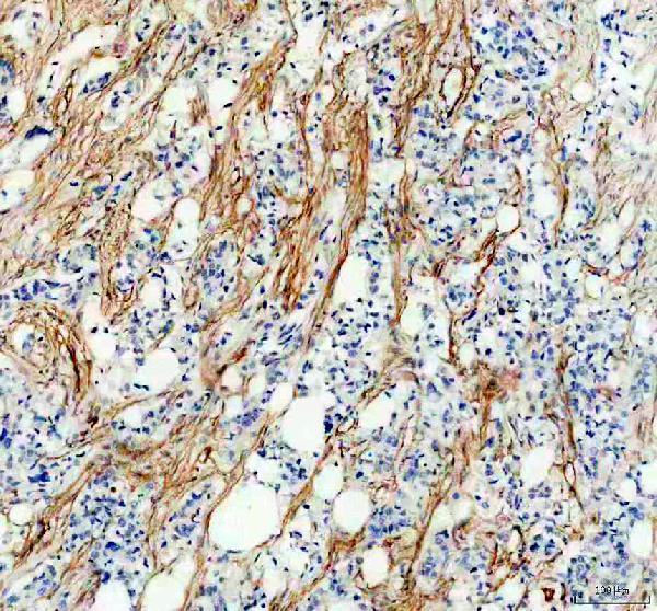 IHC analysis of PDGFRB using anti-PDGFRB antibody (M00096-7)