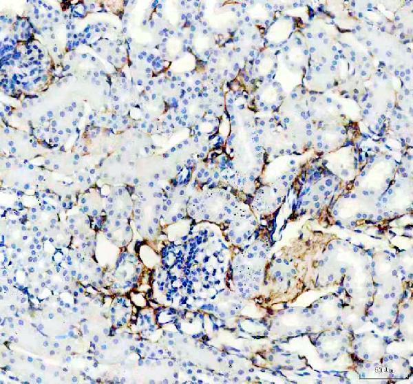 m00096 7 pdgfrb primary antibodies ihc testing 3