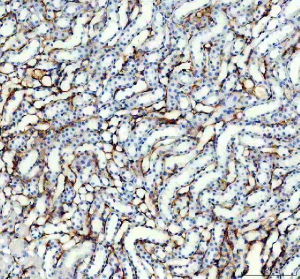 m00096 7 pdgfrb primary antibodies ihc testing 4