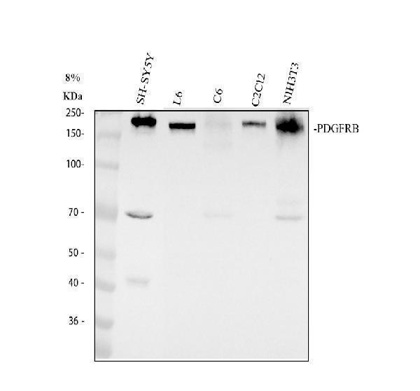 Western blot analysis of PDGFRB using anti-PDGFRB antibody (M00096-7)