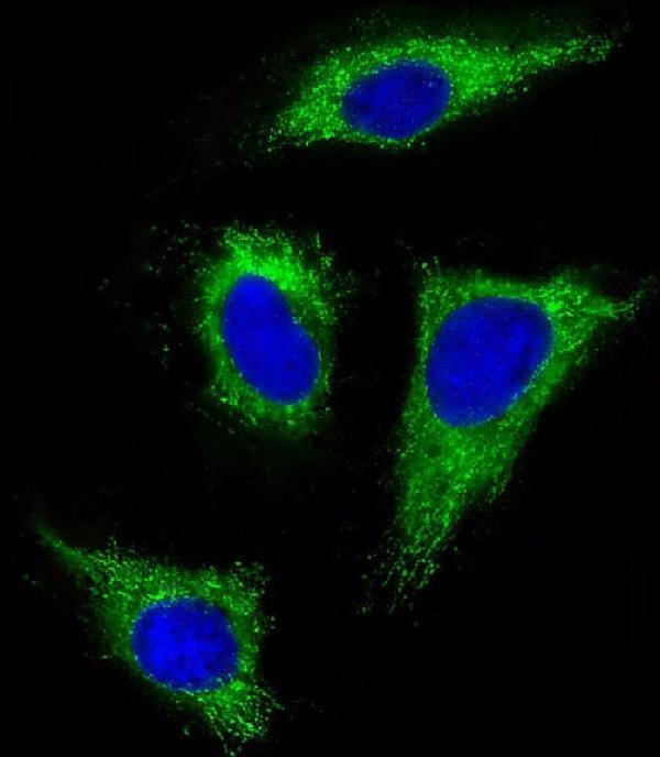 m00098 1 anti fgfr1 antibody c term if testing 1