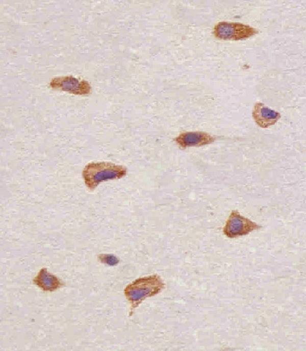 m00098 1 anti fgfr1 antibody c term ihc p testing 3