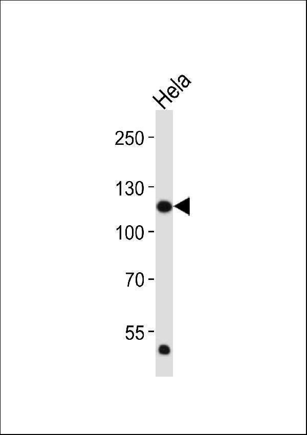 m00098 1 anti fgfr1 antibody c term wb testing 2