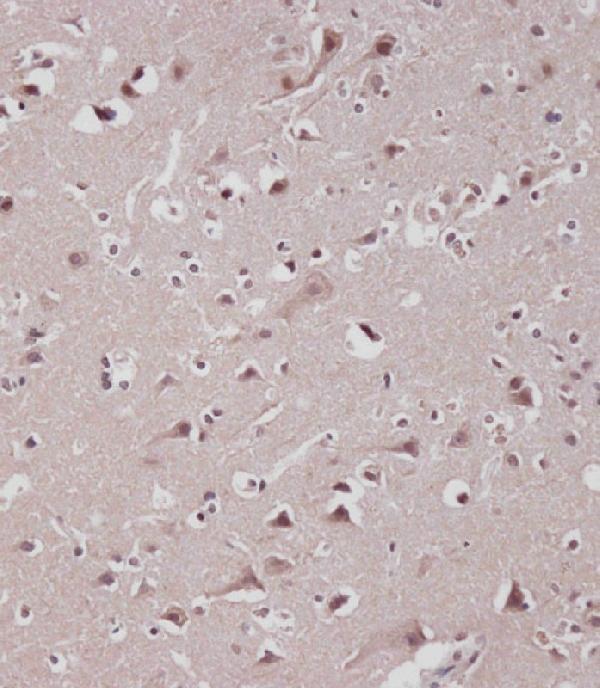 m00098 2 anti fgfry766 antibody ihc p testing 2