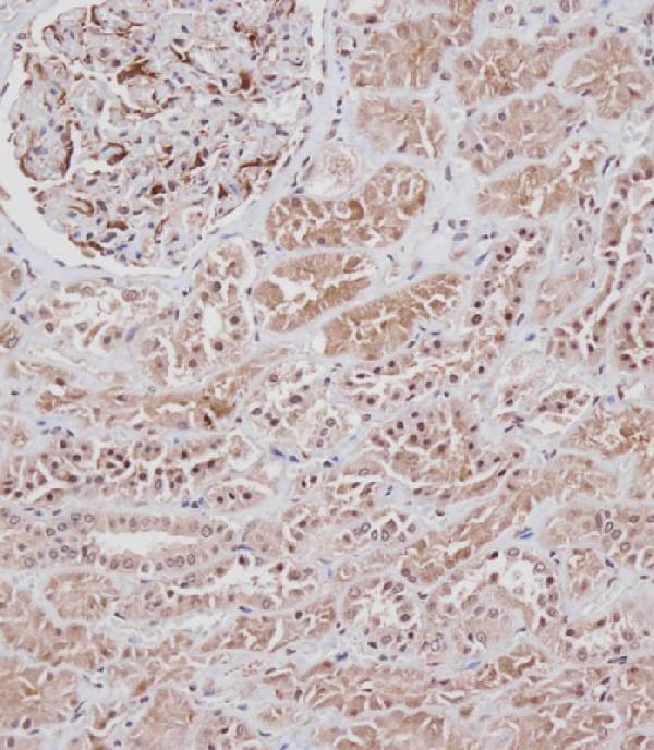 m00098 2 anti fgfry766 antibody ihc p testing 3