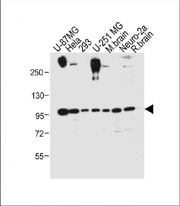m00098 2 anti fgfry766 antibody wb testing 1