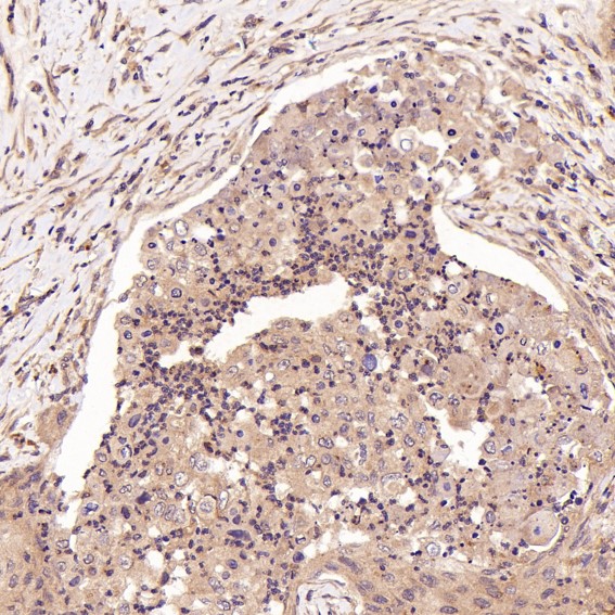 m00098 ihc8