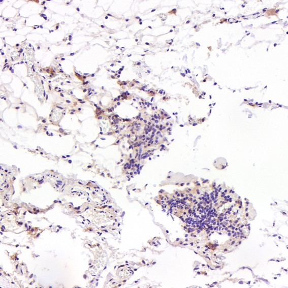 m00098 ihc9