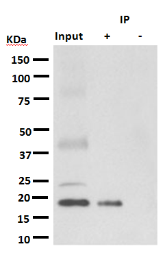 KRAS+HRAS+NRAS was immunoprecipitated from 1mg of A549 whole cell lysate