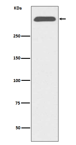 Western blot analysis of ApoB expression in human serum lysate