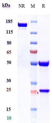 Anti-IL-1b Reference Antibody (canakinumab) on SDS-PAGE under reducing (R) condition