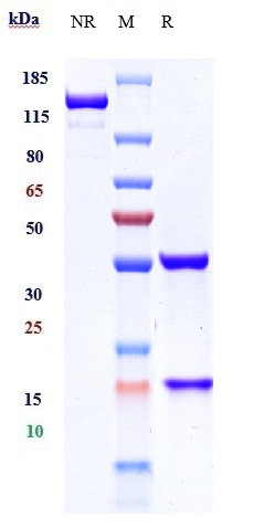 Anti-IL-1b Reference Antibody (gevokizumab) on SDS-PAGE under reducing (R) condition