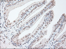 Immunohistochemical staining of paraffin-embedded Human prostate tissue within the normal limits using anti-IL-6 mouse monoclonal antibody