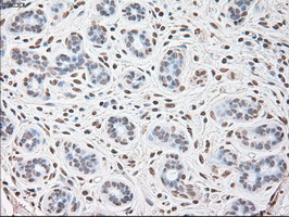 Immunohistochemical staining of paraffin-embedded Human breast tissue within the normal limits using anti-IL-6 mouse monoclonal antibody