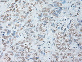 m00102 3 anti il6 mouse monoclonal antibody clone id oti3g9 ihc testing 12
