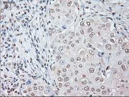 m00102 3 anti il6 mouse monoclonal antibody clone id oti3g9 ihc testing 13
