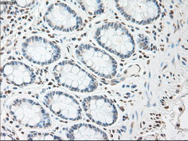 m00102 3 anti il6 mouse monoclonal antibody clone id oti3g9 ihc testing 14