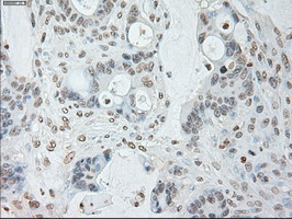 m00102 3 anti il6 mouse monoclonal antibody clone id oti3g9 ihc testing 15